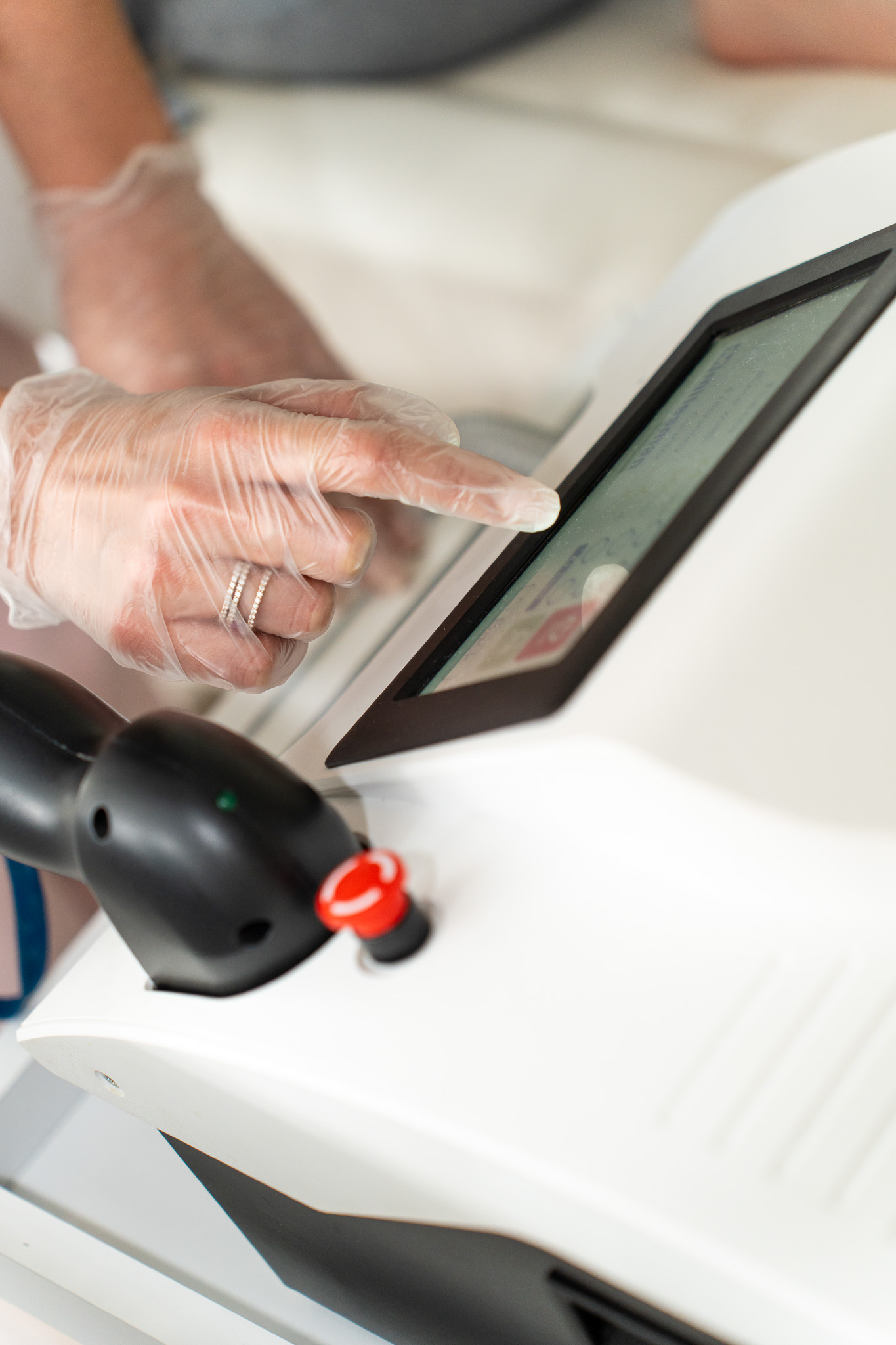 Milesman Diode Ice laser in gebruik voor medische laserontharing bij Lotta Medical Antwerpen